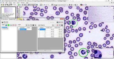 Figure 7: Digital slides are often used by educators for histology training. Utilizing digital slides and software applications, it is possible to annotate significant regions of interest.