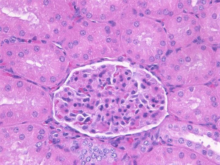 Figure 1: A paraffin section of kidney that has been fixed using neutral buffered formalin. This is an example of well-fixed tissue showing good nuclear and cytoplasmic morphology with minimal shrinkage showing clearly defined basement membranes and cell margins.