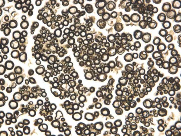 Figure 1: A transverse section of a peripheral nerve that has been fixed in osmium tetroxide (Flemming’s fluid). The myelin sheaths are preserved and stained black by this process. In this example a paraffin section has been prepared but excellent results can be achieved when polymerizing resins (epoxies or methacrylates) are used instead.