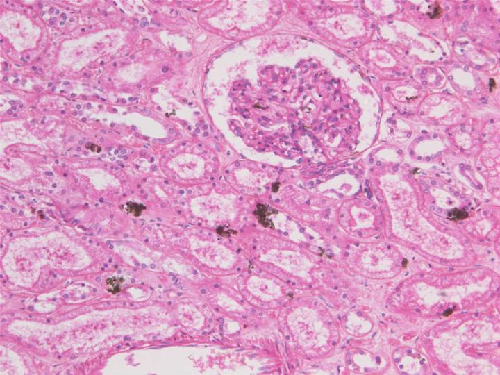 Figure 2: A section of kidney that contains randomly distributed greenish-brown deposits, an artefact produced when mercuric chloride is a component of the fixative used. In this case the section was not treated to remove the deposit prior to staining.