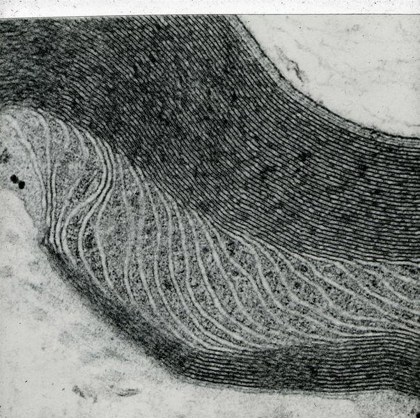 Figure 4: The Schmidt-Lanterman incisure in a myelinated nerve fibre shown at a higher magnification than in Figure 2. The multiple layers of phospholipid membrane forming the myelin sheath are well-preserved by the glutaraldehyde/osmium tetroxide fixation.