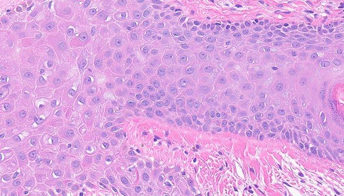 Intercellular Bridges