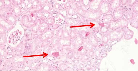 Figure 12 This section of kidney has extraneous squamous cells above the plane of the tissue. Contaminants of this type can occur within the water bath or during staining. Photo Credit: Leica Biosystems Steps to better Microtomy.