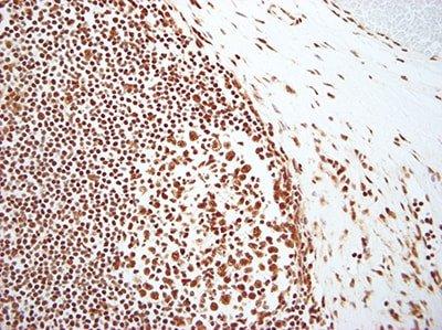 Section of tonsil stained with Poly d(T) positive control probe. The precise staining indicates that the tissue is well fixed and that RNA sequences will be well preserved.