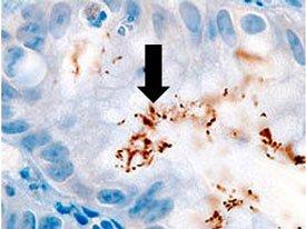 IHC IMMUNOHISTOCHEMISTRY