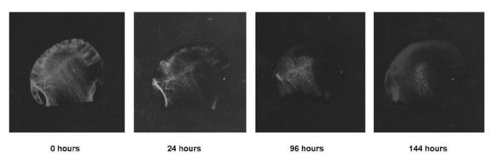 Figure 8: An X-ray series following the process of decalcification of a femoral head with formic acid/citrate decalcifier. The radiographs were produced using a Hewlett-Packard Faxitron® and allow the process to be accurately followed and the endpoint to be properly identified.