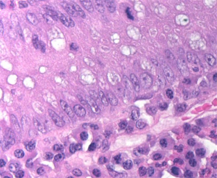 This section from the mucosa of small intestine shows well-defined heterochromatin and nucleoli in epithelial cells and plasma cells within the lamina propria