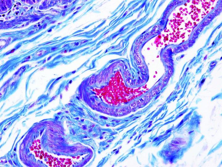 Gomori Trichrome (blue) (submucosa). Trichrome stains are used to stain and identify muscle fibers, collagen and nuclei. They can be used to contrast skeletal, cardiac or smooth muscle. The Gomori Trichrome is a simplification of the more elaborate Masson trichrome stain and combines the plasma stain (chromotrope 2R) and connective tissue stain to provide a brilliant contrasting picture.