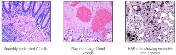 There are different staining techniques to reveal different structures of the cell