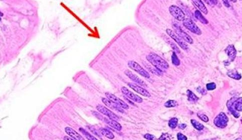 H&E Staining Overview: A Guide to Best Practices