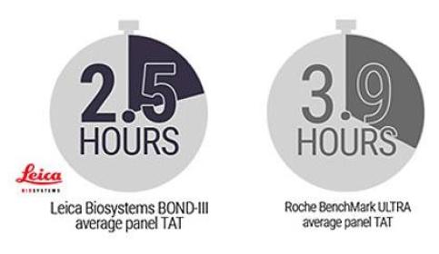 New study shows BOND-III up to 40% faster than Benchmark Ultra